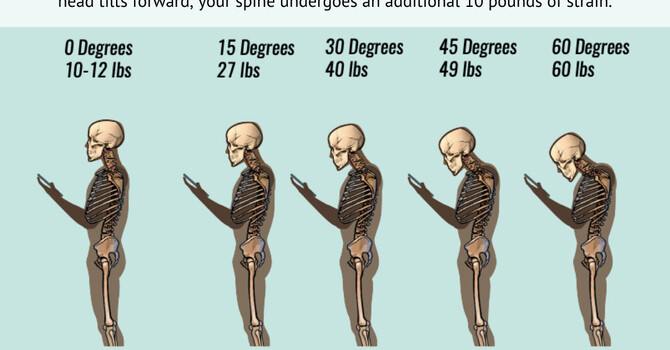 Combat Text Neck: Expert Tips from Your Eugene Chiropractor at Back2Strength image