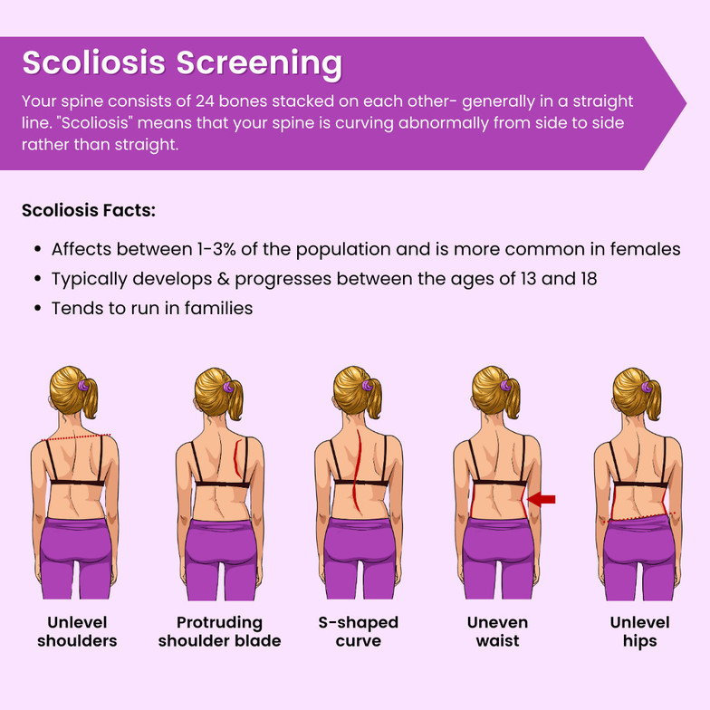 Eugene chiropractor Scoliosis